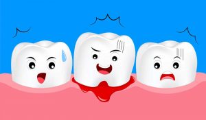 What is Gum Disease in Kids
