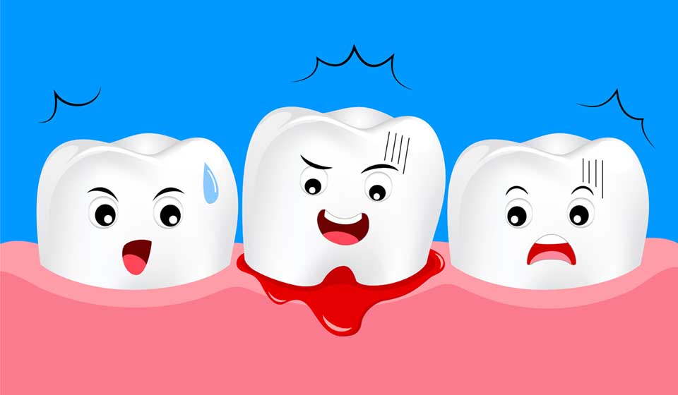 What is Gum Disease in Kids