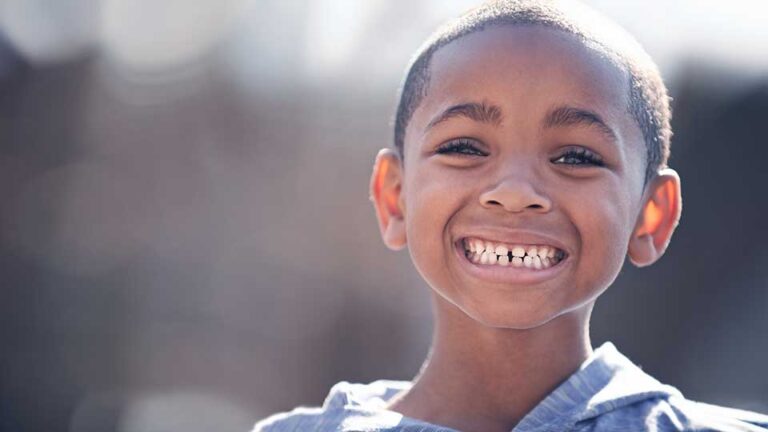 Child smiling with crooked teeth during early dental development