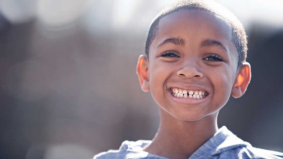 Child smiling with crooked teeth during early dental development